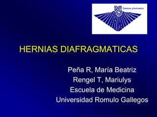 HERNIAS DIAFRAGMATICAS

         Peña R, María Beatriz
           Rengel T, Mariulys
          Escuela de Medicina
      Universidad Romulo Gallegos
 