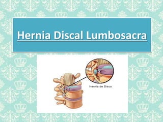 Hernia Discal Lumbosacra
 
