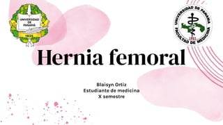 Hernia femoral
Blaisyn Ortiz
Estudiante de medicina
X semestre
 