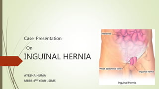 Case Presentation
On
INGUINAL HERNIA
AYESHA HUMA
MBBS 4TH YEAR , SIMS
 