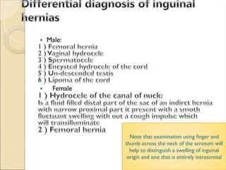 Note that examination using finger and
thumb across the neck of the scrotum will
help to distinguish a swelling of inguinal
origin and one that is entirely intrascrotal
 