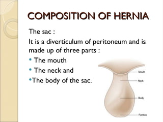 COMPOSITION OF HERNIA
COMPOSITION OF HERNIA
The sac :
It is a diverticulum of peritoneum and is
made up of three parts :
 The mouth
 The neck and
The body of the sac.
 