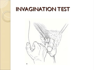 INVAGINATION TEST
INVAGINATION TEST
 