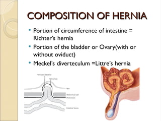 COMPOSITION OF HERNIA
COMPOSITION OF HERNIA
 Portion of circumference of intestine =
Richter’s hernia
 Portion of the bladder or Ovary(with or
without oviduct)
 Meckel’s diverteculum =Littre’s hernia
 