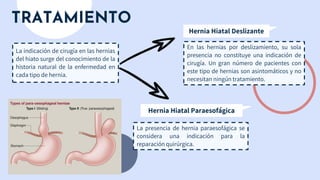 TRATAMIENTO
En las hernias por deslizamiento, su sola
presencia no constituye una indicación de
cirugía. Un gran número de pacientes con
este tipo de hernias son asintomáticos y no
necesitan ningún tratamiento.
La indicación de cirugía en las hernias
del hiato surge del conocimiento de la
historia natural de la enfermedad en
cada tipo de hernia.
Hernia Hiatal Deslizante
Hernia Hiatal Paraesofágica
La presencia de hernia paraesofágica se
considera una indicación para la
reparación quirúrgica.
 