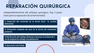 REPARACIÓN QUIRÚRGICA
Independientemente del enfoque quirúrgico, hay 4 pasos
clave para la reparación de la hernia hiatal:
1) Reducción del contenido de la hernia hacia la cavidad
abdominal.
2) Extirpación completa del saco de la hernia del mediastino
posterior.
3) Movilización del esófago distal para alcanzar un mínimo de 3
cm de longitud de esófago intraabdominal
4) Operación antirreflujo
 