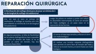 REPARACIÓN QUIRÚRGICA
3) Movilización del esófago distal para alcanzar un mínimo de 3
cm de longitud de esófago intraabdominal
En algunos pacientes, la falta de flexibilidad
de los pilares diafragmáticos hace imposible
un cierre sin tensión del hiato. Si no es
posible un cierre sin tensión, hay dos
opciones disponibles:
Una vez que el saco se extirpa del
mediastino, el esófago se moviliza aún más
para obtener un mínimo de 3 cm de longitud
intraabdominal.
Luego, los pilares se vuelven a juntar con sutura
no absorbible interrumpida. El cierre sin tensión
del hiato esofágico es un paso clave en la
reparación de las hernias.
(1) cerrar el hiato bajo tensión y reforzar el cierre
con malla biológica
(2) realizar una incisión relajante diafragmática
para permitir el cierre libre de tensión del hiato y
reforzar la incisión hecha y el cierre hiatal con malla
biológica.
 