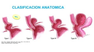 CLASIFICACION ANATOMICA
 