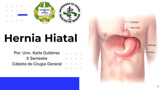 Hernia Hiatal
Por: Univ. Karla Gutiérrez
X Semestre
Cátedra de Cirugía General
1
 