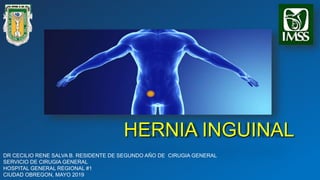 HERNIA INGUINAL
DR CECILIO RENE SALVA B. RESIDENTE DE SEGUNDO AÑO DE CIRUGIA GENERAL
SERVICIO DE CIRUGIA GENERAL
HOSPITAL GENERAL REGIONAL #1
CIUDAD OBREGON, MAYO 2019
 