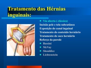 Tratamento das Hérnias inguinais: Via aberta ( clássica) Incisão pele e tela subcutânea Exposição do canal inguinal Tratamento do conteúdo herniário Tratamento do saco herniário Reforço da parede Bassini McVay Shouldice Lichtenstein 