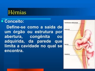 Hérnias   Conceito:  Define-se como a saída de um órgão ou estrutura por abertura, congênita ou adquirida, da parede que limita a cavidade no qual se encontra. 