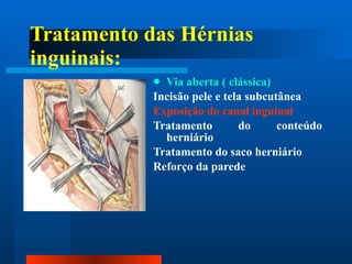 Tratamento das Hérnias inguinais: Via aberta ( clássica) Incisão pele e tela subcutânea Exposição do canal inguinal Tratamento do conteúdo herniário Tratamento do saco herniário Reforço da parede 