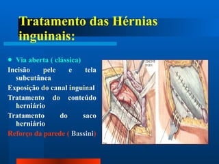 Tratamento das Hérnias inguinais: Via aberta ( clássica) Incisão pele e tela subcutânea Exposição do canal inguinal Tratamento do conteúdo herniário Tratamento do saco herniário Reforço da parede (  Bassini ) 
