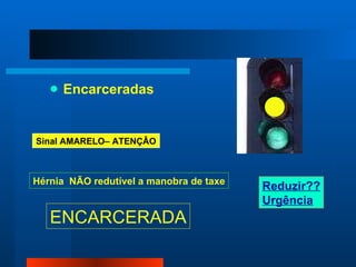 Encarceradas Sinal AMARELO– ATENÇÂO Hérnia  NÃO redutível a manobra de taxe ENCARCERADA Reduzir?? Urgência 