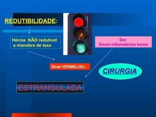 REDUTIBILIDADE : Sinal VERMELHO–   Hérnia  NÃO redutível a manobra de taxe ESTRANGULADA Dor  Sinais Inflamatórios locais CIRURGIA 