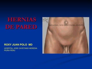 HERNIAS
DE PARED

ROXY JUAN POLO MD
HOSPITAL JOSE CAYETANO HEREDIA
PIURA PERU
 