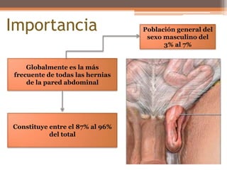 ImportanciaPoblación general del sexo masculino del 3% al 7%Globalmente es la más frecuente de todas las hernias de la pared abdominalConstituye entre el 87% al 96% del total 
