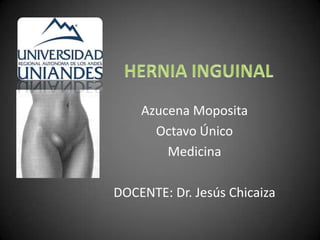 Azucena Moposita
      Octavo Único
        Medicina

DOCENTE: Dr. Jesús Chicaiza
 