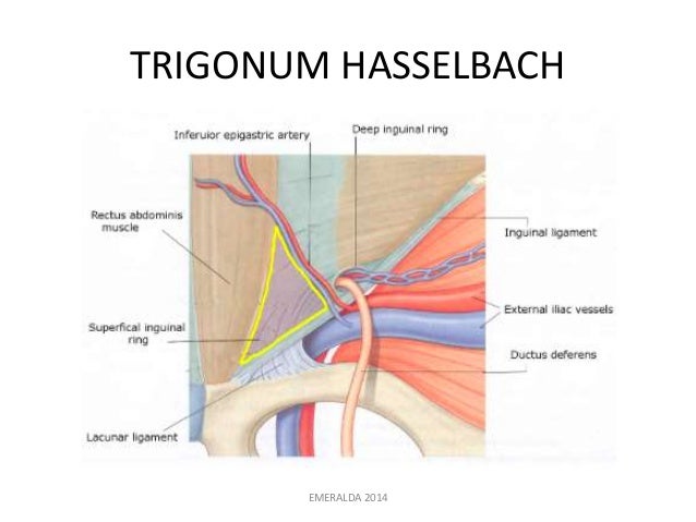 Inguinal Hernia