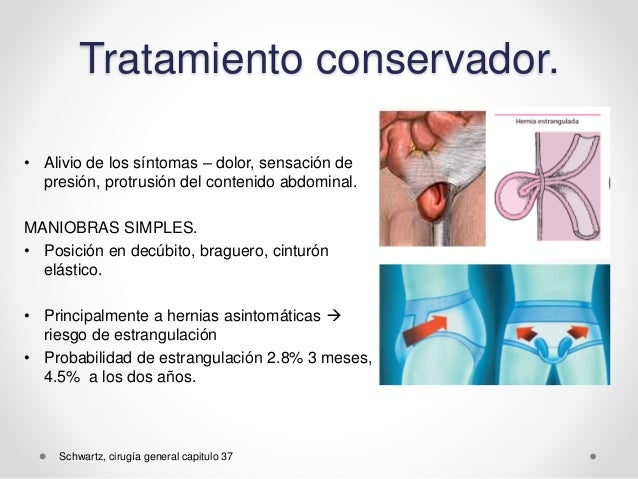 Sintomas De Hernia Estrangulada Inguinal - Noticias Formosago