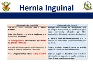 Hernia Inguinal
 