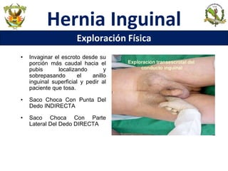 Hernia Inguinal
Exploración Física
• Invaginar el escroto desde su
porción más caudal hacia el
pubis localizando y
sobrepasando el anillo
inguinal superficial y pedir al
paciente que tosa.
• Saco Choca Con Punta Del
Dedo INDIRECTA
• Saco Choca Con Parte
Lateral Del Dedo DIRECTA
 