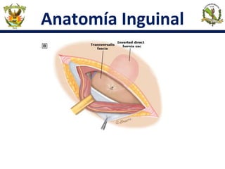 Anatomía Inguinal
 