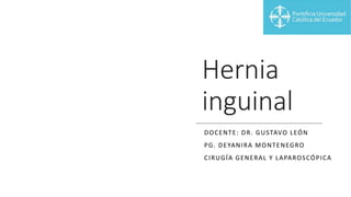 Hernia
inguinal
DOCENTE: DR. GUSTAVO LEÓN
PG. DEYANIRA MONTENEGRO
CIRUGÍA GENERAL Y LAPAROSCÓPICA
 