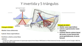 Furtado et al. (2019). Systemization of Laparoscopic Inguinal Hernia Repair (TAPP) Based on A New Anatomical Concept: Inverted Y and Five Triangles. ABCD Arq
Bras Cir Dig, 32(1): e1426.
Y invertida y 5 triángulos
Triángulo DOOM:
Medial: Vasos deferentes
Lateral: Vasos espermáticos
Contiene: arteria y vena ilíaca
externa
Triángulo de dolor:
 Medial: vasos espermáticos
 Lateral y superiormente: tracto
iliopúbico
 Contiene: Nervio cutáneo lateral
del muslo, la rama femoral del
nervio genitofemoral, el nervio
femoral.
 