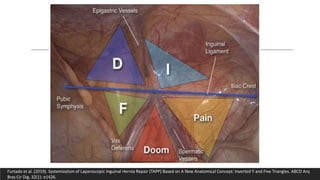 Furtado et al. (2019). Systemization of Laparoscopic Inguinal Hernia Repair (TAPP) Based on A New Anatomical Concept: Inverted Y and Five Triangles. ABCD Arq
Bras Cir Dig, 32(1): e1426.
 