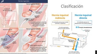 Clasificación
 