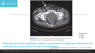Presencia de hernias inguinales al tiempo que permiten el diagnóstico diferencial con
otros trastornos que pueden simular el cuadro clínico
PRINCIPIOS DE CIRUGIA SCHWARTZ 10.ª Edición. F. Charles Brunicardi, Dana K. Andersen, Timothy R. Billiar, David L. Dunn, John G. Hunter, Jeffrey B. Matthews, Raphael E. Pollock. 2015
Resonancia:
S: 94%
E: 96%
Ultrasonido musculo esquelético práctico. Segunda edición . Elsevier España. McNally,
Eugene G. 2014
 