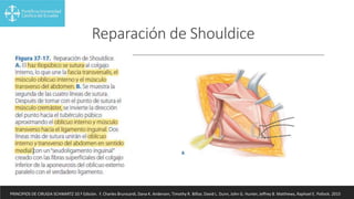 Reparación de Shouldice
PRINCIPIOS DE CIRUGIA SCHWARTZ 10.ª Edición. F. Charles Brunicardi, Dana K. Andersen, Timothy R. Billiar, David L. Dunn, John G. Hunter, Jeffrey B. Matthews, Raphael E. Pollock. 2015
 