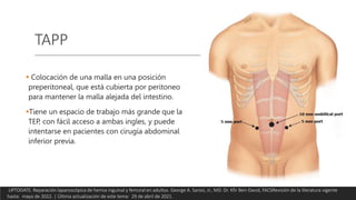 TAPP
 Colocación de una malla en una posición
preperitoneal, que está cubierta por peritoneo
para mantener la malla alejada del intestino.
Tiene un espacio de trabajo más grande que la
TEP, con fácil acceso a ambas ingles, y puede
intentarse en pacientes con cirugía abdominal
inferior previa.
UPTODATE. Reparación laparoscópica de hernia inguinal y femoral en adultos. George A. Sarosi, Jr., MD. Dr. Kfir Ben-David, FACSRevisión de la literatura vigente
hasta: mayo de 2022. | Última actualización de este tema: 29 de abril de 2021.
 