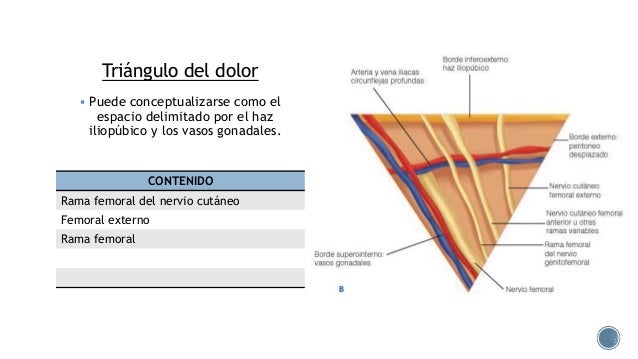 Hernia inguinal