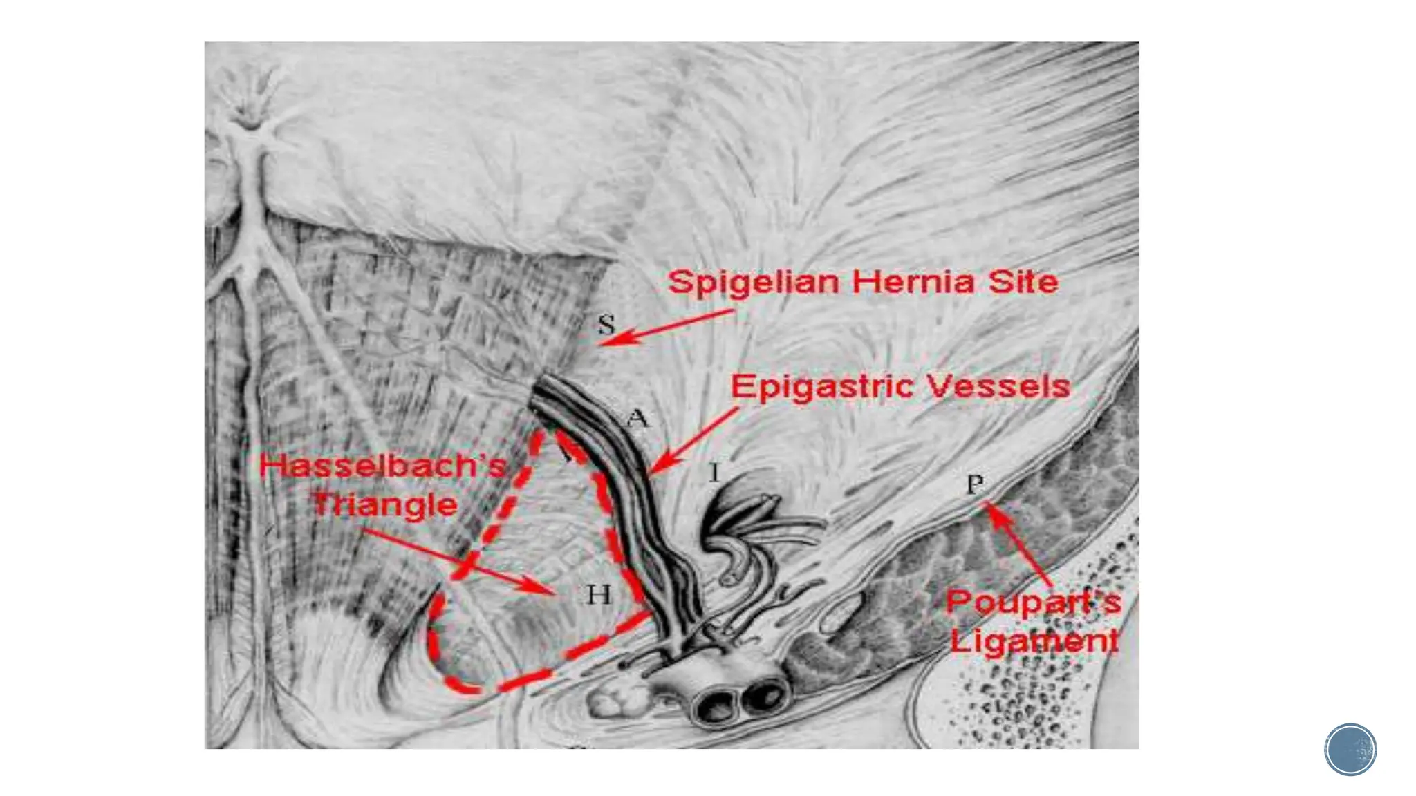 hernia inguinal anatomia fisiologia y tratamiento quirurgico | PPTX