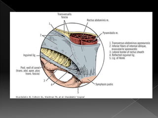 Hernia inguinal con tension