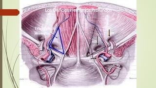 Los Orificios Herniarios Profundos
Triangulo de
Hesselbach
HD
HI
HC
 