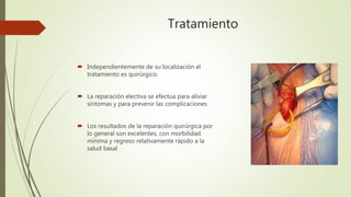 Tratamiento
 Independientemente de su localización el
tratamiento es quirúrgico.
 La reparación electiva se efectúa para aliviar
síntomas y para prevenir las complicaciones
 Los resultados de la reparación quirúrgica por
lo general son excelentes, con morbilidad
mínima y regreso relativamente rápido a la
salud basal
 