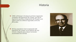 Historia
 1898 Lothheissen introdujo la primera reparación
verdadera del ligamento de Cooper, que fija el
ligamento pectíneo al ligamento de Poupart y así
repara tanto los defecto inguinales como los
femorales.
 McVay popularizo mas la reparación del
ligamento de Cooper con la adición de una
incisión relajante para reducir la tensión
aumentada de la herida
 