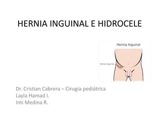 HERNIA INGUINAL E HIDROCELE
Dr. Cristian Cabrera – Cirugía pediátrica
Layla Hamad I.
Inti Medina R.
 