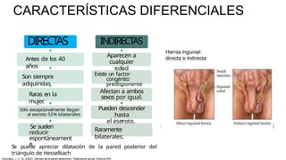 CARACTERÍSTICAS DIFERENCIALES
DIRECT
AS
Antes de los 40
años
Son siempre
adquiridas
Raras en la
mujer
.
Sólo excepcionalmente llegan
al escroto 55% bilaterales
Se suelen
reducir
espontáneament
e
INDIRECTAS
Aparecen a
cualquier
edad
Existe un factor
congénito
predisponente
Afectan a ambos
sexos por igual.
Pueden descender
hasta
el escroto.
Raramente
bilaterales.
Se puede apreciar dilatación de la pared posterior del
triángulo de Hesselbach
González, J. C. M. (2023). Hernias de la pared abdominal: Tratamiento actual. Editorial Alfil.
 