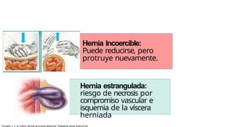 Hernia Incoercible:
Puede reducirse, pero
protruye nuevamente.
Hernia estrangulada:
riesgo de necrosis por
compromiso vascular e
isquemia de la víscera
herniada
González, J. C. M. (2023). Hernias de la pared abdominal: Tratamiento actual. Editorial Alfil.
 