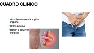 CUADRO CLINICO
Abombamiento en la región
inguinal
Dolor inguinal
Presión o pesantez en la región
inguinal
 