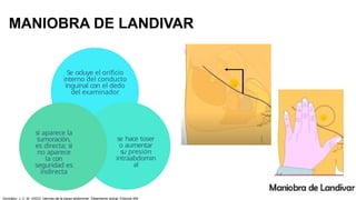 MANIOBRA DE LANDIVAR
Se ocluye el orificio
interno del conducto
inguinal con el dedo
del examinador
se hace toser
o aumentar
su presión
intraabdomin
al
si aparece la
tumoración,
es directa; si
no aparece
la con
seguridad es
indirecta
González, J. C. M. (2023). Hernias de la pared abdominal: Tratamiento actual. Editorial Alfil.
 