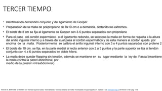 TERCER TIEMPO
• Identificación del tendón conjunto y del ligamento de Cooper.
• Preparación de la malla de polipropileno de 8x10 cm o a demanda, cortando los extremos.
• El borde de 8 cm se fija al ligamento de Cooper con 3-5 puntos separados con proprolene
• Para el paso del cordón espermático o el ligamento redondo, se secciona la malla en forma de raqueta a la altura
del anillo inguinal interno y a través del cual pasa el cordón espermático y de esta manera el cordón queda por
encima de la malla. Posteriormente se calibra el anillo inguinal interno con 3 o 4 puntos separados con prolene 2
• El borde de 10 cm. se fija, en la parte medial al recto anterior con 2 a 3 puntos y la parte superior se tija al tendón
conjunto con 4 a 6 puntos separados en doble hilera.
• La malla debe quedar flopping sin tensión, además se mantiene en su lugar mediante la ley de Pascal (mantiene
la malla contra la pared abdominal, por
medio de la presión intraabdominal).
ROCHE S, BERTONE S, BRANDI CD: Hernias inguinocrurales. Generalidades. Técnicas abiertas sin malla. Enciclopedia Cirugía Digestiva. F. Galindo y col. www.sacd.org.ar 2018;tomo I-132: pág. 1-15
 