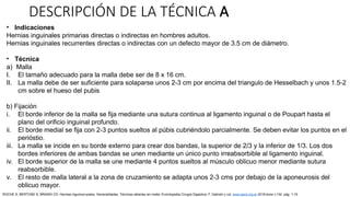 DESCRIPCIÓN DE LA TÉCNICA A
• Indicaciones
Hernias inguinales primarias directas o indirectas en hombres adultos.
Hernias inguinales recurrentes directas o indirectas con un defecto mayor de 3.5 cm de diámetro.
• Técnica
a) Malla
I. El tamaño adecuado para la malla debe ser de 8 x 16 cm.
II. La malla debe de ser suficiente para solaparse unos 2-3 cm por encima del triangulo de Hesselbach y unos 1.5-2
cm sobre el hueso del pubis
b) Fijación
i. El borde inferior de la malla se fija mediante una sutura continua al ligamento inguinal o de Poupart hasta el
plano del orificio inguinal profundo.
ii. El borde medial se fija con 2-3 puntos sueltos al púbis cubriéndolo parcialmente. Se deben evitar los puntos en el
perióstio.
iii. La malla se incide en su borde externo para crear dos bandas, la superior de 2/3 y la inferior de 1/3. Los dos
bordes inferiores de ambas bandas se unen mediante un único punto irreabsorbible al ligamento inguinal.
iv. El borde superior de la malla se une mediante 4 puntos sueltos al músculo oblicuo menor mediante sutura
reabsorbible.
v. El resto de malla lateral a la zona de cruzamiento se adapta unos 2-3 cms por debajo de la aponeurosis del
oblicuo mayor.
ROCHE S, BERTONE S, BRANDI CD: Hernias inguinocrurales. Generalidades. Técnicas abiertas sin malla. Enciclopedia Cirugía Digestiva. F. Galindo y col. www.sacd.org.ar 2018;tomo I-132: pág. 1-15
 