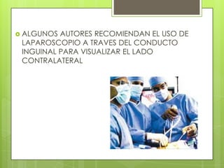  ALGUNOS AUTORES RECOMIENDAN EL USO DE
 LAPAROSCOPIO A TRAVES DEL CONDUCTO
 INGUINAL PARA VISUALIZAR EL LADO
 CONTRALATERAL
 