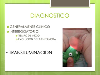 DIAGNOSTICO
 GENERALMENTE CLINICO
 INTERROGATORIO:
       TIEMPO DE INICIO
       EVOLUCION DE LA ENFERMEDA




• TRANSILUMINACION
 